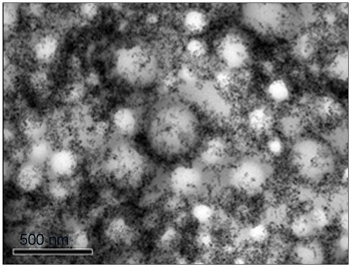 Figure 3 Transmission electron photomicrograph of M-NC showing dispersed nanoparticles on its surface.Abbreviation: M-NC, poly(lactic-co-glycolic acid)-nanocapsules loaded with magnetic nanoparticles.