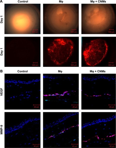Figure 7 In vivo fluorescence imaging and effect of CNMs on VEGF and MMP-9 expression in rat cornea.Notes: (A) Fluorescence micrographs of a cornea indicate the Mφ labeled with DiI located in cornea pockets on postoperative day 1 in the Mφ group and CNMs group. There were no DiI-labeled cells in the cornea pocket in the control group. Magnification ×25. (B) Confocal laser scanning microscopic images of a cornea indicate the protein expression of VEGF and MMP-9 on postoperative day 2. Visibly high expression of VEGF and MMP-9 was observed in implanted DiI-labeled Mφ, corneal stroma, and corneal endothelium in the Mφ group. There was a significant reduction in VEGF and MMP-9 expression in implanted Mφ and corneal stroma and endothelium in the CNMs group. No remarkable expression of VEGF and MMP-9 was observed in the control group.Abbreviations: CNMs, celastrol nanomicelles; DiI, 1,19-dioctadecyl-3-3-39,39-tetramethylindocarbocyanine; Mφ, macrophage; MMP-9, matrix metalloproteinases 9; VEGF, vascular endothelial growth factor.