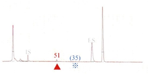 Figure 3 Result of the in situ hybridization for HPV positivity.