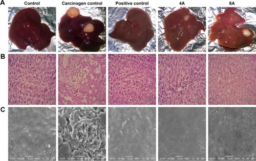 Figure 5 The hepatic pathological changes in NDEA-induced rats.