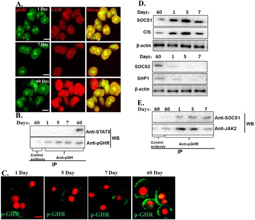 Figure 5. Exploration of possible mechanisms for JAK2-STAT5 signaling insensitivity. A. pGH could interact normally with GHR in the hepatocytes of neonatal pig. The cells were then washed for three times with PBS and fixed with 4% paraformaldehyde at 37°C for 20 min. The cells were then treated with the indicated antibodies. After washing, the cells were incubated with second antibodies labeled with Alexa Fluor 488 (green) and Alexa Fluor 555 (red). The cells were observed using confocal laser scanning microscopy (CLSM). Bar: 10 μm. B. pGH/GHR lacks the ability to recruit and activate intracellular signaling molecule. C. The plasma membrane-localized GHR was not activated by pGH in hepatocytes of neonatal pig. D. The expression of negative regulatory molecules for JAK2-STAT5 signaling. E. SOCS1 could interact with JAK2/GHR complex in the hepatocytes of neonatal pig.