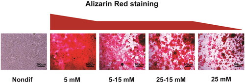 Figure 1. Representative microphotography pictures of Alizarin Red staining of nondifferentiated (nondif) aortic valve interstitial cells (VICs) and VICs with induced calcification. VICs were cultivated in media with different concentration of glucose (5 mM, 5–15 mM (cells adapted from 5 to 15 mM), 25–15 mM (cells adapted from 25 to 15 mM) and 25 mM).