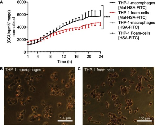 Figure 3 Real-time microscopy comparing Mal-HSA-FITC uptake by THP-1 macrophages with that by THP-1 foam cells over 24 h.Notes: (A) A significant difference between the time-dependent Mal-HSA-FITC uptake by THP-1 foam cells and THP-1 macrophages was noted by comparing the slope coefficients. No uptake of HSA-FITC probes (gray lines) was observed in either cell subtype. The results shown are pooled data from two independent experiments (triplicate wells). Nine images per well were acquired for each time point. The graph shows mean and SEM. Linear regression analysis showed significantly different slopes of the lines for THP-1 macrophages and THP-1 foam cells (****P<0.0001). (B, C) Light microscopy images were taken after ORO-staining (red) with a 20× objective of (B) THP-1 macrophages and (C) THP-1 foam cells, showing stronger ORO-staining compared with THP-1 macrophages.Abbreviations: HSA, human serum albumin; GCU, green calibration unit; ORO, Oil-Red-O.