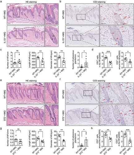 Figure 2 The pathological changes of HFs and T cells infiltration were alleviated in IL-33−/− and ST2−/− mice in IMQ-induced psoriatic model. (a) H & E staining of lesion skin in WT psoriatic mice and IL-33−/− psoriatic mice (n = 6 per group). Scale bar=100μm. (i) infundibulum, (ii) outer root sheath, (iii) sebaceous glands. (b) Immunohistochemical staining of CD3 in WT psoriatic mice and IL-33−/− psoriatic mice (n = 6 per group). Scale bar = 100μm. Red arrows indicate CD3-positive T cells. (c and d) Statistical data of HFs number, HFs length, HFs diameter, sebaceous gland number and CD3-positive cells. (e) H & E staining of lesion skin in WT psoriatic mice and ST2−/− psoriatic mice (n = 6 per group). Scale bar=100μm. (i) infundibulum, (ii) outer root sheath, (iii) sebaceous glands. (f) Immunohistochemical staining of CD3 in WT psoriatic mice and ST2−/− psoriatic mice (n = 6 per group). Scale bar = 100μm. Red arrows indicate CD3-positive T cells. (g and h) Statistical data of HFs number, HFs length, HFs diameter, sebaceous gland number and CD3-positive cells. Data are representative of three independent experiments. Significance was determined by a two-tailed Student’s t-test. * P<0.05, ** P<0.01, *** P<0.001.