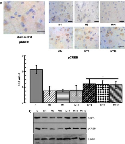 Figure 2 The expression of CREB and pCREB in the hippocampus by immunohistochemistry and Western blotting.
