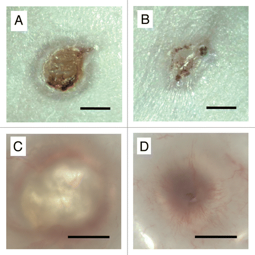 Figure 1 Photomicrographs of (A and C) control and (B and D) HUCPVC-containing wounds at 7 days. Note in (A) the size of the original circular wound and with annular repair and central eschar. (B) The HUCPVC-treated wound shows more advanced repair. (C and D) Wounds viewed by transillumination show little vascularization in the control (C) but marked radial arrays of blood vessels in the HUCPVC treated wound (D). Bars = 2 mm.