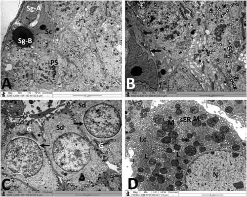 Figure 4. Electron micrographs of testicular tissue from the control group. (A) Normal appearance of spermatogonia type A (Sg-A) and B (Sg-B), primary spermatocytes (PS) and Sertoli cell (Sc). (B) Higher magnification of Figure 3(A) showing Sertoli-Sertoli junctional complexes (arrows). (C) Round spermatids (Sd) at the phase of acrosomal formation. Arrow: acrosomal cap, G: Golgi apparatus. (D) Leydig cell (Lc) with nucleus (N) depicting fine granular chromatin and clear nuclear membranes, mitochondria (M), smooth endoplasmic reticula (sER) and lipid droplets (L). Scale bar: 10 µm (A), 5 µm (B, C), 2 µm (D).