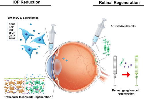 Figure 4 Stem cell use for ocular protection and regeneration. Neurotropic factors released by bone marrow-derived mesenchymal stem cells and Müller cells induce the regeneration of the trabecular meshwork and retinal ganglion cells.