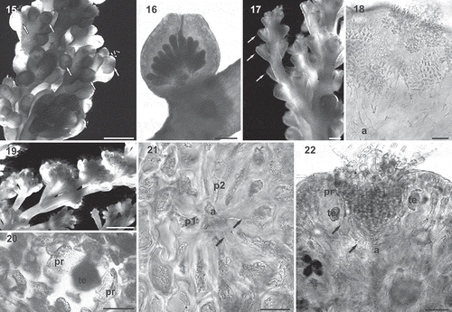 Figs 15–22. Laurencia pyramidalis from the Lusitanian Macaronesian region: reproductive structures. 15. Female gametophyte with cystocarps (arrows) located on the penultimate branches; they are subapical, sessile and prominent. Scale bar = 1 mm. 16. Longitudinal section showing a slightly pyriform cystocarp with a non-protuberant ostiole and clavate carposporangia. Scale bar = 200 µm. 17. Male gametophyte with spermatangial receptacles (arrows) located on the ultimate fertile branchlets. Scale bar = 500 µm. 18. Longitudinal section of a cup-shaped spermatangial receptacle. An axial cell (a) is discernible at the base bearing a fertile branch with many ovoid spermatangia. Scale bar = 50 µm. 19. Tetrasporangial plants with cylindrical branchlets. Scale bar = 2 mm. 20. Surface view of a tetrasporangium (te) with two presporangial cover cells (pr). Scale bar = 30 µm. 21. Transverse section near the apex of axial tetrasporangial segments with an axial cell (a), two vegetative pericentral cells (p1, p2) and two fertile pericentral cells (arrows). Scale bar = 30 µm. 22. Longitudinal section through a tetrasporangial branchlet showing the parallel arrangement of the tetrasporangia. Each fertile pericentral cell (arrows) cuts off presporangial cover cells (pr) distal to the initial tetrasporangium (te). Scale bar = 50 µm.