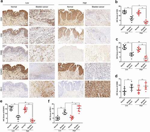 Figure 9. IHC staining (a) showed the expression of CD3 (b), CD8 (c), CD68 (d), FOXP3 (e) and PD-1 (f) in low grade bladder cancer tissues, high grade bladder cancer tissues and adjacent normal tissues. ** p < 0.01, # p < 0.05, ## p < 0.01.