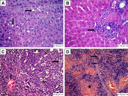 Figure 7 Histopathological changes in free metoclopramide-treated group.Notes: (A) Liver shows clear vacuoles in hepatic cells (arrow); (B) liver shows Kupffer-cell proliferation (notched arrow); (C) lymph nodes show congestion (arrow) and apoptosis in some lymphocytes in lymphoid follicles (notched arrow); (D) Spleen shows focal areas of hemorrhage (star) and hemosiderosis (arrow); H&E.