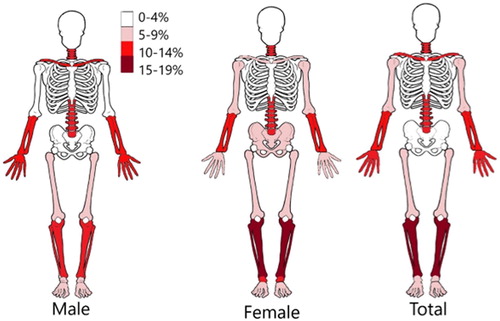 Figure 3. Percentage of fractures within the different body regions for persons involved in all matched crashes.