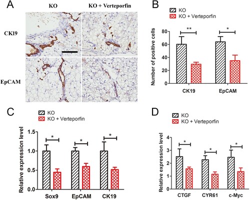 Figure 6. Verteporfin abrogated Yap signalling activity and alleviated ductular reactions in G6pc−/− mice. (A) Verteporfin treatment reduced CK19 and EpCAM-positive cells in liver of G6pc−/− mice. (B) Quantification of positive cell number in A. (C) qRT-PCR analysis showed that verteporfin treatment reduced expression levels of CK19, EpCAM and SOX9. (D) qRT-PCR analysis showed that Yap1 target genes, CTGF, CYR61, and c-Myc, were significantly decreased in G6pc KO mice after verteporfin treatment. Scale bar = 200 μm. N = 8. *P < 0.05 and **P < 0.01 compared to WT group.