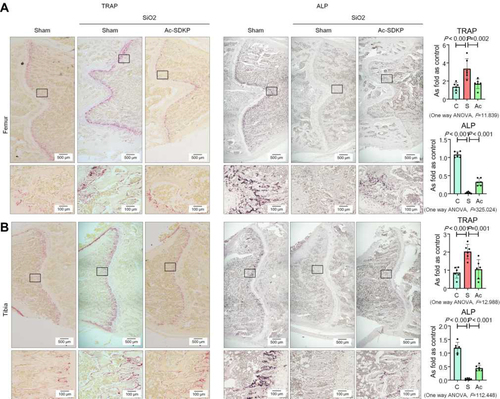 Figure 9 Ac-SDKP inhibits osteoclast differentiation in silicotic rats. (A) TRAP staining and ALP staining in the femur, Bar= 500 μm and 100 μm; (B) TRAP staining and ALP staining in the tibia, Bar= 500 μm and 100 μm.
