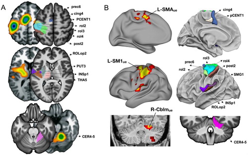 Figure 5. Location of the 13 hROIs showed in the left hemisphere that were selected in the present work. (A) Comparison with the map of the main effect of all finger-tapping tasks in the meta-analysis conducted by Witt (adapted from Witt et al., Citation2008). The ALE maps are shown side to side with the hROIs of the present work that are labelled on axial slices of the left hemisphere and right cerebellum (B) Comparison with the regions involved in the motor network for hand movements as explored with intrinsic connectivity by Newbold together with lateral left hemisphere presentation of the hROIs of the present work, note that in Newbold the coral slice presenting the right cerebellum is in a non-radiological convention (adapted from Newbold et al., Citation2020).