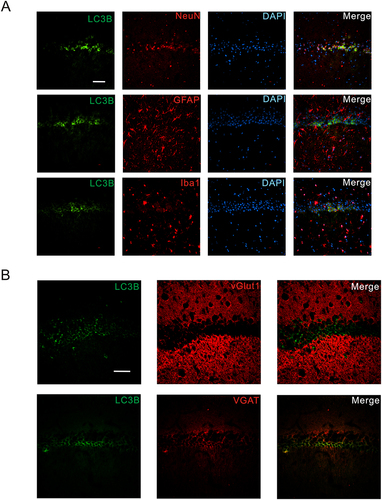 Figure 5 ZnO NPs affect inhibitory neuronal autophagy. (A). Localization of LC3 in neurons, astrocytes and microglia. (B). Localization Scale bars of LC3 in excitatory and inhibitory neurons. Scale bars: 50 μm.