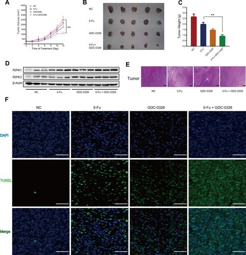 Figure 5 GDC-0326 enhanced the effects of 5-Fu on suppressing CRC tumor growth in vivo. (A) Growth curve of tumor volumes after injection of LoVo cells in xenograft nude mice from the DMSO, 5-Fu, GDC-0326, and combination treatment groups. (B and C) The xenografted tumors were surgically removed and photographed, as well as weighed (n = 5). (D) Protein levels of RIPK1 and RIPK3 were detected by Western blotting analysis in each group. β-Actin was used as a loading control. (E) H&E staining of tumor slices from different groups after various treatments (scale bar = 200 µm). (F) TUNEL immunofluorescence staining of tumor slices from the groups (scale bar = 100 µm). (**P < 0.01).