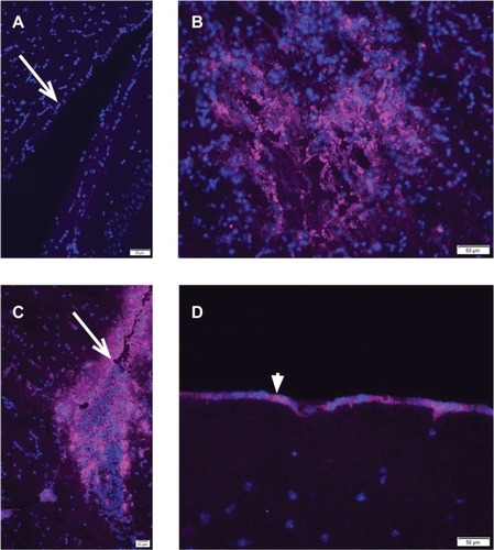 Figure 1 Immunohistochemistry of vaccinia virus vvDD-IL15-Rα in brains of tumor-bearing, inoculated mice.
