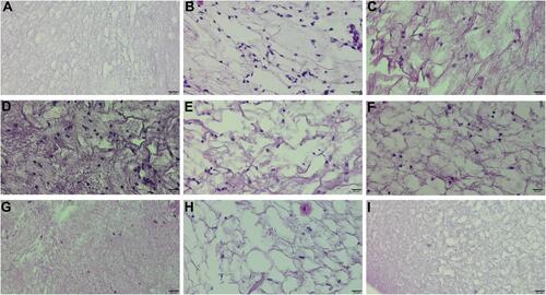 Figure 5 The photomicrographs of exudate of carrageenan-injected paw after hematoxylin-eosin staining demonstrated that the studied compounds reduced inflammatory cell infiltration. Indomethacin was used as a reference drug. Experimental groups: control group (A); carrageenan group (B); group receiving 10 mg/kg indomethacin (C); group receiving 5 mg/kg compound 10b (D); group receiving 10 mg/kg compound 10b (E); group receiving 20 mg/kg compound 10b (F); group receiving 5 mg/kg compound 13b (G); group receiving 10 mg/kg compound 13b (H); group receiving 20 mg/kg compound 13b (I); magnification 400×.