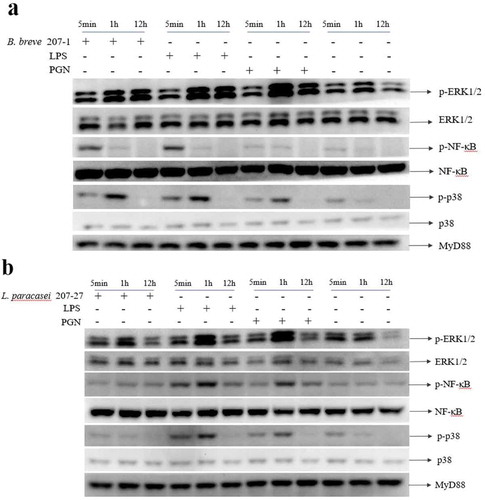 Figure 4. Bifidobacteria and lactobacilli can activate TLR2-MyD88-mediated multiple signal pathway which may mediated secreting of IL-10.(a)Macrophages stimulated by B. breve 207–1 total protein was tested by western blotting, analyzed using rabbit anti-phospho-p44/p42 MAPK, rabbit anti-phospho-p38, rabbit anti-phospho-Transcription factor of the nuclear factor κB, rabbit anti-MyD88,mouse-anti-p44/p42 MAPK, mouse-anti-p38, rabbit anti-NF-κB (b) Macrophages stimulated by L.paracasei 207–27 total protein was tested by western blotting and analyzed using the same antibody