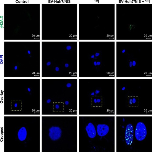 Figure 4 Effect of EV-Huh7/NIS, 131I, 131I-mediated effects by the EV-Huh7/NIS pretreatment of Huh7 cells.Notes: γH2A.X and DAPI were visualized by blue and green, respectively (scale bar: 20 μm). The yellow dotted square indicates the cropping region of overlay images.Abbreviation: EV, extracellular vesicle.