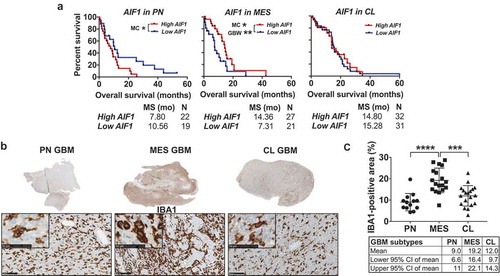 Figure 2. MES GBM is characterized by increased presence of TAM compared to the PN and CL subtypes. (a) Kaplan-Meier curves created using data provided by TCGA comparing the effects of different expression levels of AIF1 on overall survival in GBM subtypes. High AIF1 expression levels confer a worse prognosis in the PN subtype, but bestow a survival benefit in MES tumors. No effect is seen in patients with CL GBM. High and low expression levels were defined as the average of all samples in each subtype ± 0.5 standard deviations. MC = Log-rank (Mantel-Cox) test, GBW = Gehan-Breslow-Wilcoxon test. (b) Tumor sections (scale bars represent 5 mm) and representative images of GBM samples demonstrating differential immunohistochemical IBA1 staining among distinct GBM subtypes. IBA1 labels TAM in dark brown and nuclei are counterstained in blue using hematoxylin. Scale bar lengths correspond to 100 micrometers and 50 micrometers (inserted images). (c) Quantification of the percentage of IBA1-positive area in the different GBM subtypes. Each data point represents the average of one tumor. PN = Proneural, MES = Mesenchymal, CL = Classical.