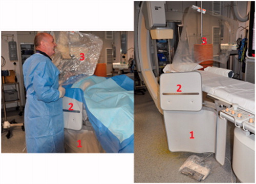 Figure 2. Radioprotection shields 1 and 3 are used routinely. Shield 2 is used less frequently, but when used leads to significant radiation dose reduction for the operator (discussion 6).