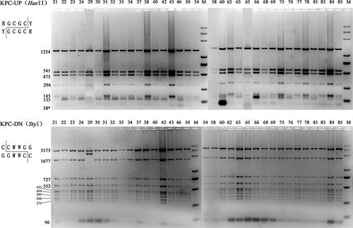 Figure 3 PCR-RFLP profiles of genetic background of blaKPC-2 Restriction endonucleases used to digest the PCR products of blaKPC-2 franking fragments are listed in the parentheses. The predicted sizes of digested fragments are marked beside the bands. Invisible predicted bands were marked with asterisks. M, DL5000 DNA marker (TSINGKE, China).
