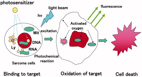 Figure 2. Mechanism of cytocidal effect of photodynamic therapy. Irradiation with light beam induces the formation of activated oxygen through energy transfer. Activated oxygen is highly reactive and cytotoxic. It reacts with biomolecules (i.e. lipids, proteins, and nucleic acids of cellular or lysosomal origin) inducing cell death through activation of the apoptotic pathway.