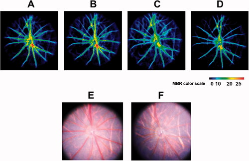 Figure 3. Representative color-coded maps of optic nerve head blood flow by LSFG-Micro and fundus photos in systemic aldosterone-treated rats. Blood flow image in the optic nerve head obtained before administration (baseline, A) and 1 (B), 2 (C), and 4 (D) weeks after administration of aldosterone. The color scale is shown at the bottom right. Fundus photographs taken before (E) and 4 weeks after (F) systemic administration of aldosterone in the same eye as (A–D). LSFG: laser speckle flowgraphy.