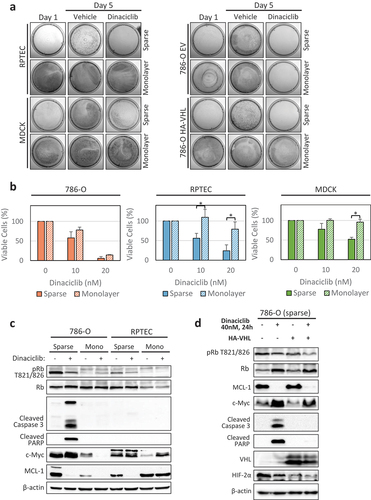 Figure 3. Dinaciclib has a therapeutic window under cell culture conditions inhibiting cell divisions. (a) Inhibition of cell division rate by plating the cells at high cell density (monolayer) protects two normal cell lines–RPTEC (non-transformed Renal Proximal Tubule Epithelial Cells) and MDCK (Madin-Darby Canine Kidney cells)–as well as 786-O HA-VHL cancer cell line with re-introduced VHL, but not VHL-deficient 786-O, from Dinaciclib cytotoxicity. Cells were plated at low (sparse, ~5% confluency) or high (monolayer, 100% confluency) density in 6 cm plates, treated for 5 days with 40 nM Dinaciclib or vehicle (DMSO), followed by staining with Crystal Violet. (b) Confirmation of results in (a) by cell viability CTG assay. Cells were plated in 96-well plates and treated for 5 days with 10 nM and 20 nM Dinaciclib or vehicle (DMSO). The results were normalized to vehicle-treated cells. n = 3 (786–0 and RPTEC), n = 2 (MDCK), error bars correspond to SEM. Significance was calculated using unpaired student’s t test. *p < 0.05. (c) Dinaciclib induces expression of apoptosis markers only in sparse 786-O cells, but not in sparse RPTEC cells. Dinaciclib decreases MCL-1 and c-Myc expression only in monolayer 786-O cells, but not in monolayer RPTEC cells. Cells were treated with 40 nM Dinaciclib for 24 hours and analyzed by western blot. Monolayer cell culture conditions effectively decreased Rb phosphorylation in both cell lines as compared to sparse conditions, indicating cell cycle arrest. (d) Dinaciclib induces expression of apoptosis markers only in sparse 786-O cells, but not in sparse 786-O HA-VHL cells. Dinaciclib treatment decreases Rb phosphorylation and MCL-1 expression in both 786-O and 786-O HA-VHL cell lines. VHL re-expression caused downregulation of its target protein HIF2α. Cells were plated and treated as in (c).