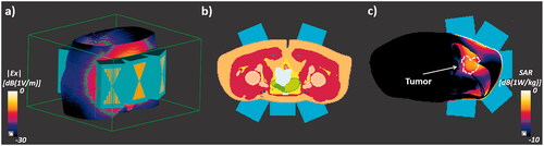 Figure 1. Modular applicator module placement for the bladder tumor setup (a); voxelized model of the cervical tumor setup (b); tumor position, element placement, and SAR distribution for the pelvic bone tumor setup (c).