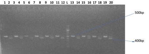 Figure 3 (B31–B40): Agarose gel electrophoresis showing the amplified CYP gene bands. Lane 1, 3, 5, 7, 9, 11, 13, 15, 17, and 19 represent the undigested CYP amplicons (Sample code B31 – B40), lane 2, 6, 8, 12, and 18 represents the digested homozygous (wild type) CYP gene, lane 4, 10, 14, 16, and 20 represent the heterozygous CYP gene (wild and mutant allele), while lane L represents the 100bp molecular ladder.