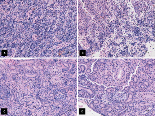 Figure 4. Histopathology of anterior and posterior kidneys of P. promelas exposed to hydroxylated fullerenes. The anterior kidney of hydroxylated fullerene-treated fish (B) often contained reduced numbers of lymphoid and myeloid cells compared to control fish (A). 400× magnification. The interstitium of the posterior kidney in this representative hydroxylated fullerene-treated fish (D) contains reduced numbers of lymphoid and myeloid cells compared to control (C). 400× magnification.