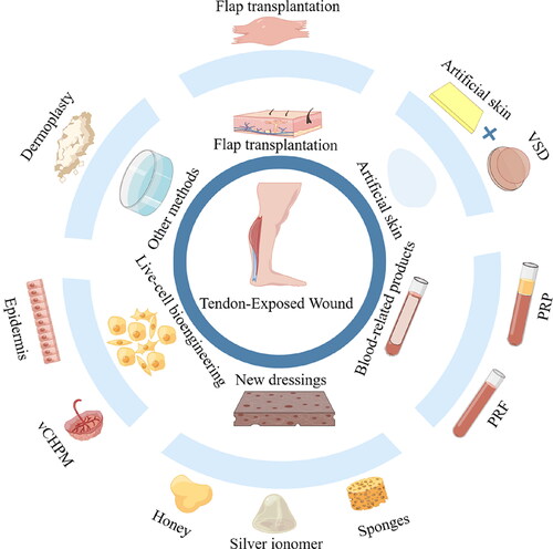 Figure 3. Treatment of tendon exposed wounds. Treatment options for exposed tendon wounds include: flap grafting, artificial skin combined with VSD, platelet rich plasma and other blood-related products, new dressings, and so on.