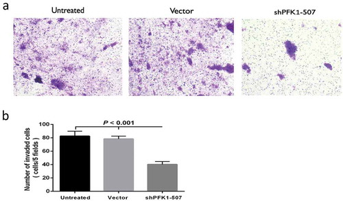 Figure 6. Stable knockdown of PFK1 inhibited invasion of CNE2 cells. (a) Representative cells invade through Matrigel and membrane. (b) Amount of invaded cells in different groups. All experiments were performed at least three times with consistent and repeatable results