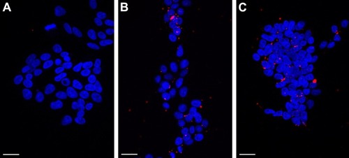 Figure 6 Confocal microscopy images of HEK293T cells transfected with Cy3-labeled siRNA alone (A), together with Lipofectamine (B), or together with reference Citation14 (C) at 1 h post-transfection.Notes: DAPI (4′,6-damidino-2-phenylindole) labeling was used to stain the chromatin (blue). Scale bars, 25 µm. Composition of reference Citation14: 200 mg stearic acid, 300 mg cholesteryl oleate, 600 mg octadecylamine, 100 mg poloxamer 188.