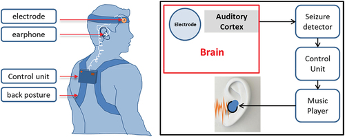 Figure 1. System schematic for seizure control including the implantable electrode.