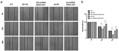 Figure 4. Lnc-ADD3-AS1 promoted cell migration in LX-2 cells. (a) Images of transfected cells were captured at 0, 24, and 48 h after the wound scratch. The representative images were from three independent experiments. Scale bar: 100 μm. (b) The migration potency was determined by calculating the difference in wound width. Data are shown as mean ± SEM. ***P < 0.001.