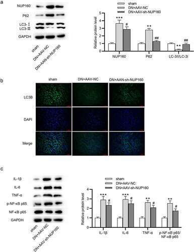 Figure 7. Effects of NUP160 depletion on autophagy and inflammatory response in DN mice. (a) The protein expression of autophagy-related markers and Col-IV in DN mice was determined by western blot. (b) The expression of LC3B in DN mice was determined by immunofluorescence assay. (c) The protein levels of IL-1β, IL-6, and TNF-α in DN mice were examined by western blot. **P < 0.01, ***P < 0.001 vs. the sham group; #P < 0.05, ##P < 0.01 vs. the DN+AAV-NC group