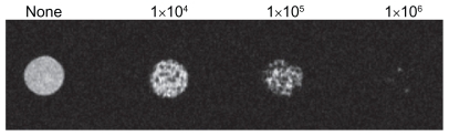 Figure 3 Signal intensity of superparamagnetic iron oxide-labeled dendritic cells (25 μg/mL, 12 hours incubation) by magnetic resonance imaging in vitro assay.