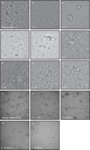 Fig. 4.  TEM images of fractions. Starting material and fractions, undiluted or 50-fold diluted when indicated, were analysed by TEM for the presence of particles. All images shown are representative images for the starting material (a, j) and fractions 5, 9, 10, 11, 17, 18, 19 and 20 (b–i, k–n). Scale bar is 200 nm (a–g, j–n), 500 nm (h), or 1 µm (i).