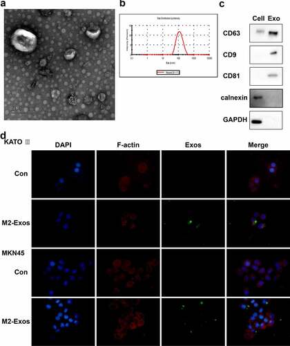 Figure 2. Exosomes derived from M2-polarized macrophages can be absorbed by gastric carcinoma cells. Exosomes were isolated from M2 macrophages. (A) the morphology of exosomes was observed in transmission electron microscopy. (B) the size of exosomes was assessed by nanoparticle tracking analysis. (C) the markers of exosomes were detected using Western blot. (D) Immunofluorescence staining was performed.