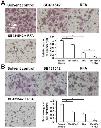 Figure 7 In vitro invasion or migration of BC cells separated from subcutaneous tumors. The subcutaneous tumor tissues (Figure 4) were harvested, and single cells were separated. Transwell experiments were then performed to determine in vitro invasion or migration. Photographs of in vitro invasion (A) and migration (B). The results are the mean±SD. *P<0.05.Abbreviation: BC, bladder cancer.