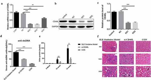 Figure 1. Identification of the role of CD40L in systemic lupus erythematosus mouse model (a) Quantitative PCR detects the CD40L mRNA level. Three shRNAs were designed targeting CD40L which were LV-CD40L-shRNA1 (KD-1), LV-CD40L-shRNA2 (KD-2), LV-CD40L-shRNA3 (KD-3). As showed in this part the knock down percentage of KD1 and KD2 was more than 50% and they were selected for the following experiment. ‘NC’ is the group transfected with lentivirus vector GV493. KD1, KD2, KD3 were GV493 insert with three shRNAs targeting CD40L. (b & c) Western blot detected the CD40L protein level. (d) Serum anti-dsDNA antibody level. (e) Urinary protein in mice was examined and CD40L alleviated the pathological changes in mouse kidneys. (f) HE staining detected the pathological changes in mouse kidneys. In (D)-(F) SLE oxidative model group, mice were injected with CD4 + T cells treated by H2O2; si-CD40L group, mice were injected with CD4 + T cells transfected with LV-CD40L-shRNA1 (KD-1). Control group, the negative control of transfection. Each group contained 6 mice and three independent repeats for each experiment. One-way ANOVA was used for statistical analysis. *P < 0.05, **P < 0.01, ***P < 0.001.