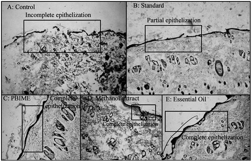 Figure 4. Histological changes in the incision wounds on the 10th day after treatment with different extracts of S. robusta. There is incomplete epithelization in the control (A) and framycetin (standard)-treated animals while the incision wounds in SRME (methanol extract), SRPEBIME (PEBIME), and SREO (essential oil)-treated groups showed complete epithelization.