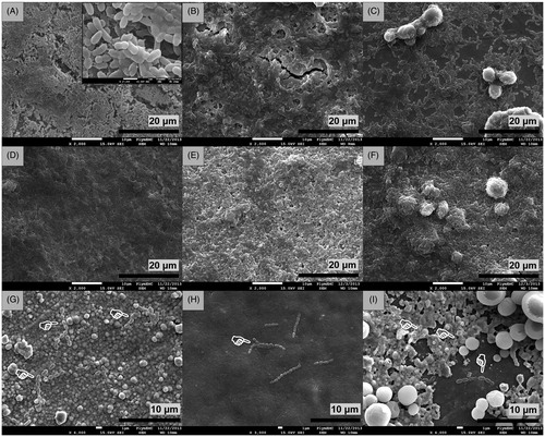 Figure 4. Scanning electron micrographs of Ti6Al4V discs after 24 h of incubation in inoculated media showing (A) formation of S. sanguinis biofilm on uncoated control discs (×2.0k), (B) biofilm formation on discs coated with nHA (×2.0k), (C) biofilm formation on discs coated with mHA (×2.0k), (D) biofilm development on anodised discs (×2.0k), (E) biofilm development on anodised discs coated with nHA (×2.0k), (F) biofilm development on anodised discs coated with mHA (×2.0k), (G) biofilm inhibition on silver plated discs (×4.0k), (H) biofilm inhibition on silver plated discs coated with nHA (×3.0k) and (I) biofilm inhibition on silver plated discs coated with mHA (×4.0k). White pointers indicate the locations of limited bacteria found adhered on the surfaces of silver plated groups.