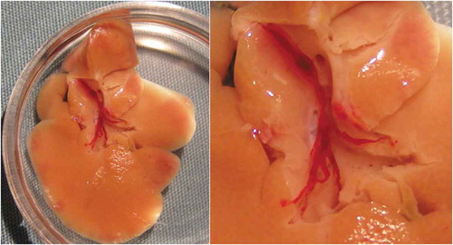 Figure 2. Large thrombus filling the branches of portal vein inside of an ischemic rat liver 2 h after transplantation of 1000 syngeneic pancreatic islets.