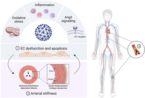 Figure 2 Overview of COVID-19 related vascular complications. SARS-CoV-2 infection gives rise to enhanced oxidative stress, inflammation and angiotensin II (AngII)-angiotensin II type 1 (AT1) receptor signalling, which ultimately leads to endothelial cell (EC) dysfunction and apoptotic cell death (1). An important consequence of EC dysfunction is the development of arterial stiffness due to impaired nitric oxide bioavailability. Also remodelling of the extracellular matrix, leading to a lower elastin/collagen ratio, contributes to arterial stiffness development (2). The increase in vascular stiffness can further damage ECs, thereby resulting in a vicious cycle. Eventually these pathophysiological mechanisms can drive the development of atherosclerosis, peripheral and coronary artery disease (3). (Created with BioRender.com).