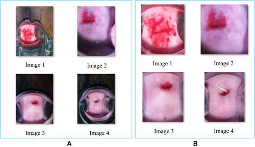 Figure 4 Sample results of the Cervix ROI extraction model (A) input images (B) ROI extracted images.